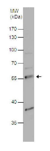 Western blot - Anti-PDP1/PDP antibody (AB228578)