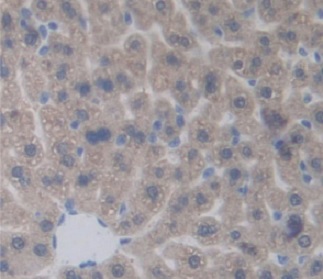 Immunohistochemistry (Formalin/PFA-fixed paraffin-embedded sections) - Anti-PDP2 antibody (AB233517), expandable thumbnail