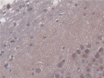 Immunohistochemistry (Formalin/PFA-fixed paraffin-embedded sections) - Anti-PDP2 antibody (AB233517), expandable thumbnail
