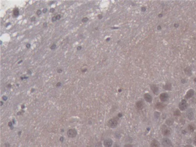 Immunohistochemistry (Formalin/PFA-fixed paraffin-embedded sections) - Anti-PDP2 antibody (AB233517)