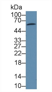 Western blot - Anti-PDP2 antibody (AB233517), expandable thumbnail