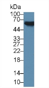 Western blot - Anti-PDP2 antibody (AB233517), expandable thumbnail