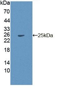 Western blot - Anti-PDP2 antibody (ab233517), expandable thumbnail
