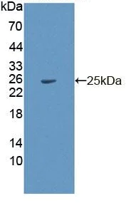 Western blot - Anti-PDP2 antibody (AB233517)