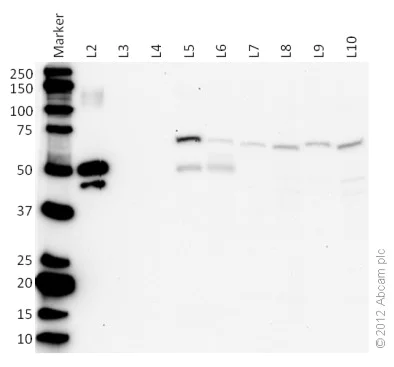 Western blot - Anti-PDP2 antibody [MS41A 3C3BC10] (AB133982)