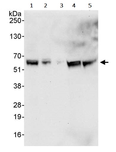 Western blot - Anti-PDPK1 antibody (AB245451), expandable thumbnail
