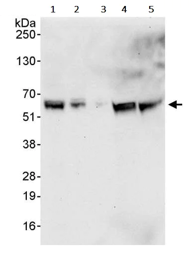 Western blot - Anti-PDPK1 antibody (AB245451)