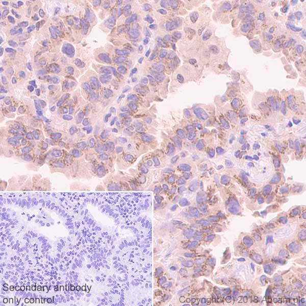 Immunohistochemistry (Formalin/PFA-fixed paraffin-embedded sections) - Anti-PDPK1 antibody [EP569Y] (AB52893)