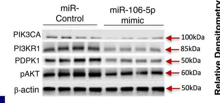 Western blot - Anti-PDPK1 antibody [EP569Y] (AB52893)