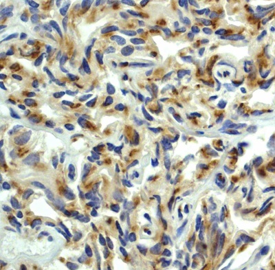 Immunohistochemistry (Formalin/PFA-fixed paraffin-embedded sections) - Anti-PDPK1 antibody [EP569Y] - BSA and Azide free (AB236004)
