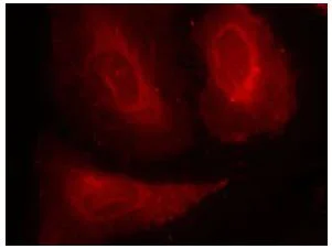 Immunocytochemistry/ Immunofluorescence - Anti-PDPK1 (phospho S241) antibody (AB131098)