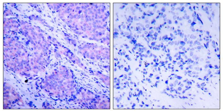 Immunohistochemistry (Formalin/PFA-fixed paraffin-embedded sections) - Anti-PDPK1 (phospho S241) antibody (AB131098)