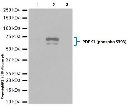 Immunoprecipitation - Anti-PDPK1 (phospho S393) antibody [EPR19818] (AB206340)