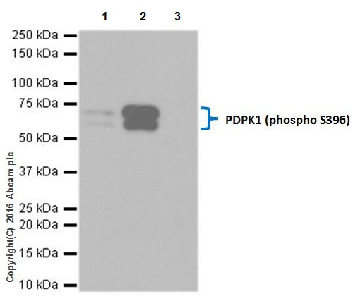 Immunoprecipitation - Anti-PDPK1 (phospho S396) antibody [EPR19819] (AB206341)