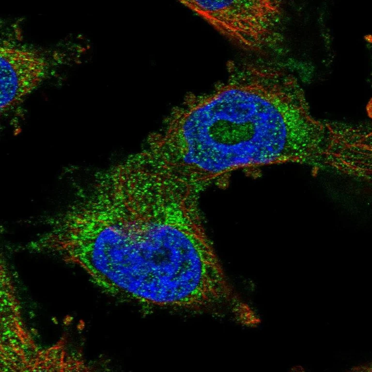 Immunocytochemistry/ Immunofluorescence - Anti-PDSS2 antibody (AB251797)