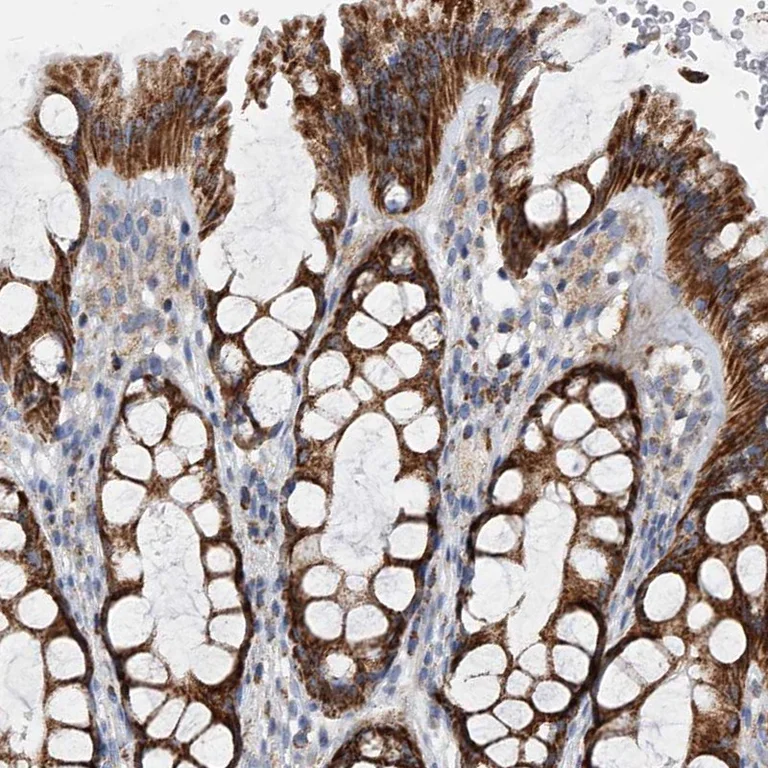 Immunohistochemistry (Formalin/PFA-fixed paraffin-embedded sections) - Anti-PDSS2 antibody (AB251797)