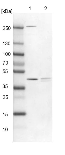Western blot - Anti-PDSS2 antibody (AB251797)
