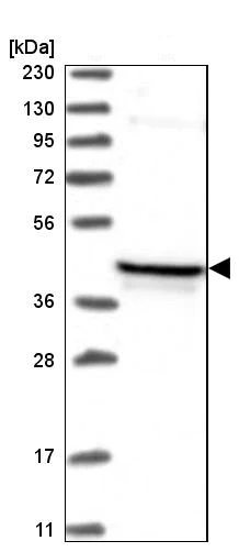 Western blot - Anti-PDSS2 antibody (AB251797)