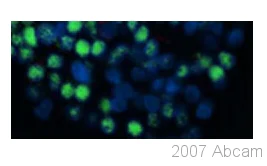Immunocytochemistry/ Immunofluorescence - Anti-PDX1 antibody (AB47267)