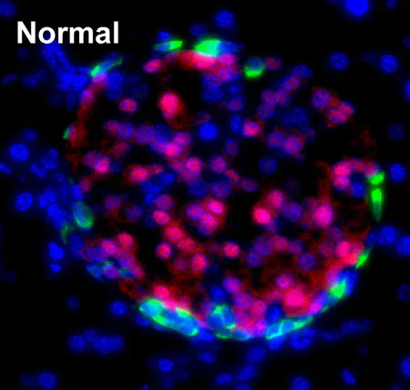 Anti-PDX1 antibody (ab47267) | Abcam