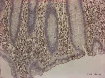 Immunohistochemistry (Formalin/PFA-fixed paraffin-embedded sections) - Anti-PDX1 antibody (AB47267)