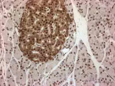 Immunohistochemistry (Formalin/PFA-fixed paraffin-embedded sections) - Anti-PDX1 antibody (AB47267)