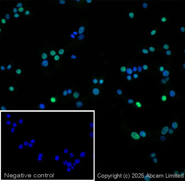 Immunocytochemistry/ Immunofluorescence - Anti-PDX1 antibody (AB47308)