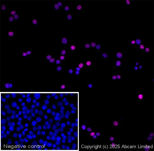 Immunocytochemistry/ Immunofluorescence - Anti-PDX1 antibody (AB47308)