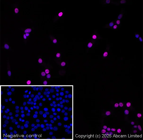 Immunocytochemistry/ Immunofluorescence - Anti-PDX1 antibody (AB47308)