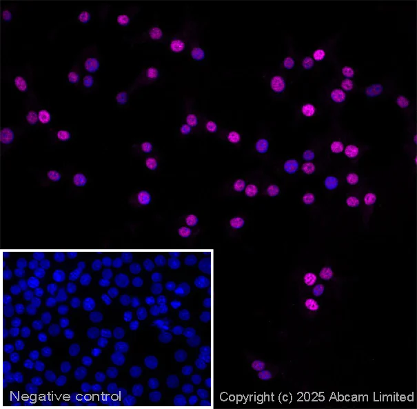 Immunocytochemistry/ Immunofluorescence - Anti-PDX1 antibody (AB47308)