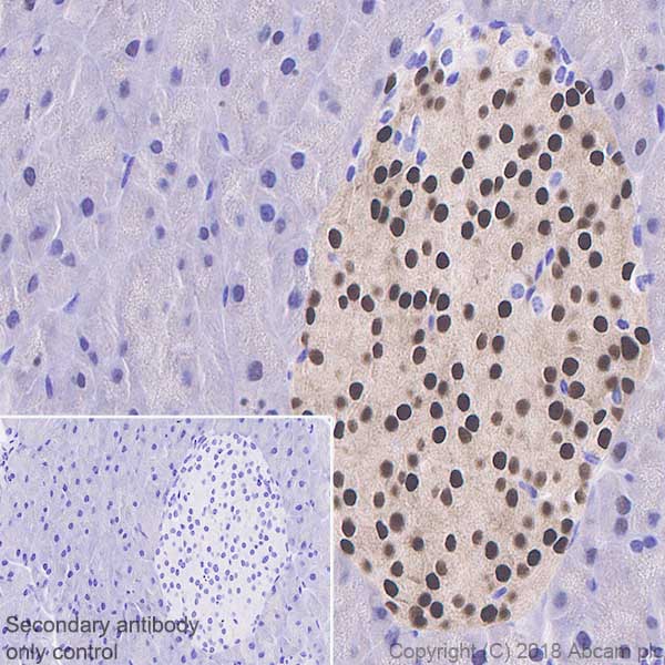 Immunohistochemistry (Formalin/PFA-fixed paraffin-embedded sections) - Anti-PDX1 antibody [EPR22002] (AB219207), expandable thumbnail