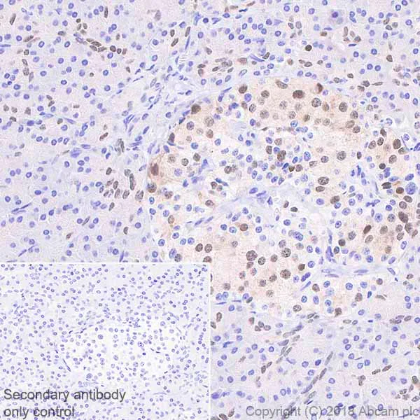 Immunohistochemistry (Formalin/PFA-fixed paraffin-embedded sections) - Anti-PDX1 antibody [EPR22002] - BSA and Azide free (AB234633)