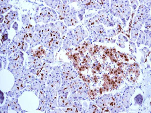 Immunohistochemistry (Formalin/PFA-fixed paraffin-embedded sections) - Anti-PDX1 antibody [EPR3358(2)] (AB134150)