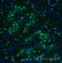 Immunohistochemistry (Formalin/PFA-fixed paraffin-embedded sections) - Anti-PDX1 antibody [EPR3358(2)] (AB134150)
