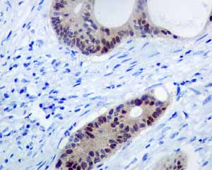 Immunohistochemistry (Formalin/PFA-fixed paraffin-embedded sections) - Anti-PDX1 antibody [EPR3358(2)] (AB134150)