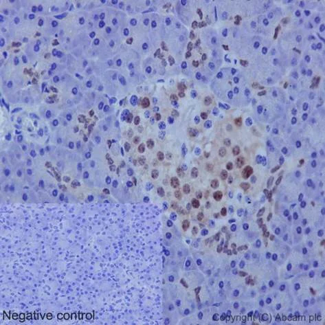 Immunohistochemistry (Formalin/PFA-fixed paraffin-embedded sections) - Anti-PDX1 antibody [EPR3358(2)] - BSA and Azide free (AB240084)