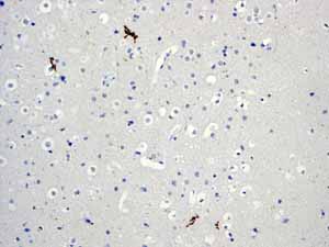 Immunohistochemistry (Formalin/PFA-fixed paraffin-embedded sections) - Anti-PDX1 antibody [EPR3358(2)] - BSA and Azide free (ab240084), expandable thumbnail