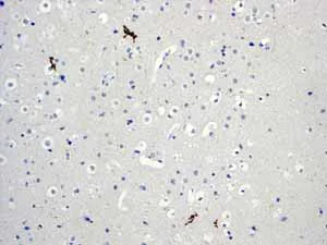 Immunohistochemistry (Formalin/PFA-fixed paraffin-embedded sections) - Anti-PDX1 antibody [EPR3358(2)] - BSA and Azide free (AB240084)