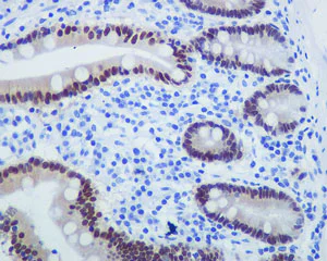 Immunohistochemistry (Formalin/PFA-fixed paraffin-embedded sections) - Anti-PDX1 antibody [EPR3358(2)] - BSA and Azide free (AB240084)