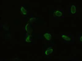 Immunocytochemistry/ Immunofluorescence - Anti-PDX1 antibody [OTI2A12] (AB84987)
