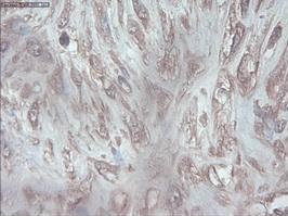 Immunohistochemistry (Formalin/PFA-fixed paraffin-embedded sections) - Anti-PDX1 antibody [OTI2A12] (AB84987), expandable thumbnail