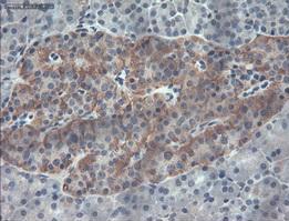 Immunohistochemistry (Formalin/PFA-fixed paraffin-embedded sections) - Anti-PDX1 antibody [OTI2A12] (AB84987), expandable thumbnail