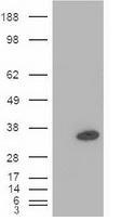 Western blot - Anti-PDX1 antibody [OTI2A12] (AB84987), expandable thumbnail