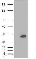 Western blot - Anti-PDX1 antibody [OTI2A12] (AB84987)