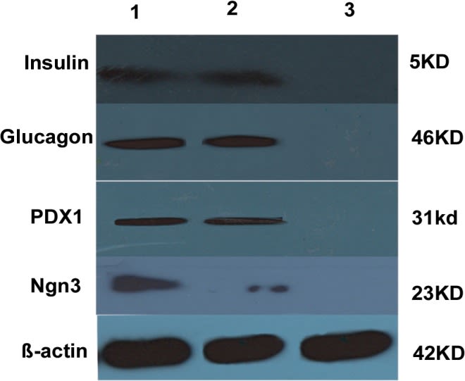 Western blot - Anti-PDX1 antibody [OTI2A12] (ab84987), expandable thumbnail