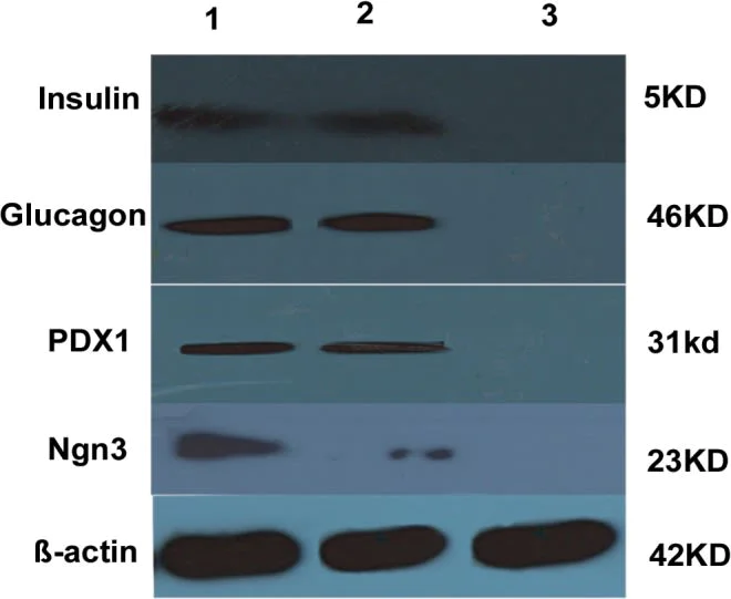 Western blot - Anti-PDX1 antibody [OTI2A12] (AB84987)