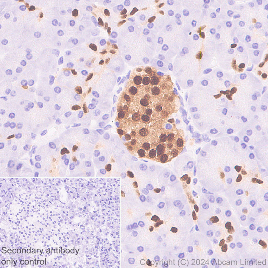 Immunohistochemistry (Formalin/PFA-fixed paraffin-embedded sections) - Anti-PDX1 antibody [RM1269] (ab323218), expandable thumbnail