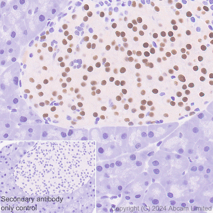 Immunohistochemistry (Formalin/PFA-fixed paraffin-embedded sections) - Anti-PDX1 antibody [RM1269] (AB323218), expandable thumbnail