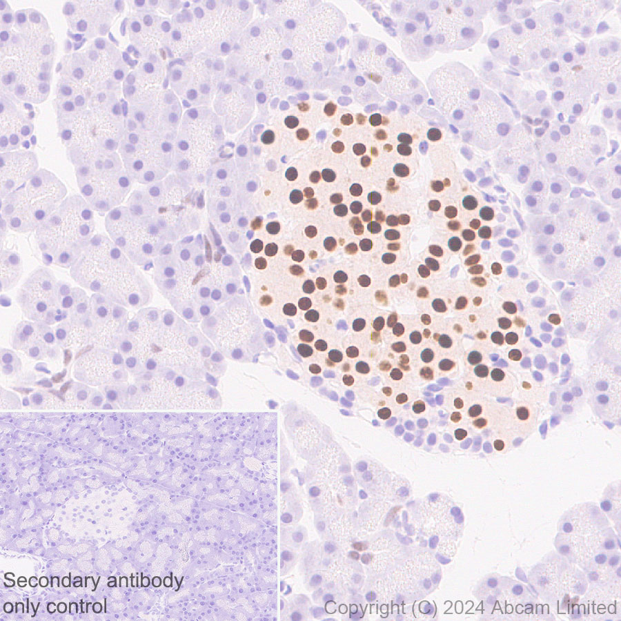 Immunohistochemistry (Formalin/PFA-fixed paraffin-embedded sections) - Anti-PDX1 antibody [RM1269] (ab323218), expandable thumbnail