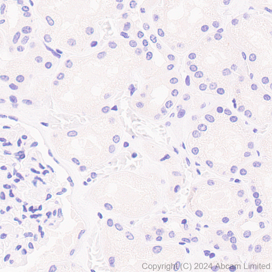 Immunohistochemistry (Formalin/PFA-fixed paraffin-embedded sections) - Anti-PDX1 antibody [RM1269] (AB323218), expandable thumbnail